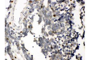 Immunohistochemistry (IHC) image for anti-Runt-Related Transcription Factor 3 (RUNX3) (AA 128-270) antibody (ABIN3043429)