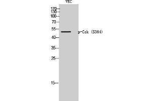Western Blotting (WB) image for anti-C-Src tyrosine Kinase (CSK) (pSer364) antibody (ABIN3182195) (CSK Antikörper  (pSer364))