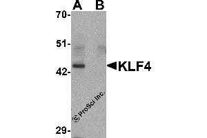 Western Blotting (WB) image for anti-Kruppel-Like Factor 4 (Gut) (KLF4) antibody (ABIN1031710) (KLF4 Antikörper)