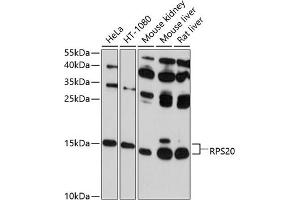Western blot analysis of extracts of various cell lines, using RPS20 antibody (ABIN6129112, ABIN6147211, ABIN6147212 and ABIN6214592) at 1:1000 dilution. (RPS20 Antikörper  (AA 1-119))