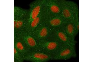 IF analysis of TOE1 using anti-TOE1 antibody (ABIN7601080) and anti-Tubulin Alpha antibody (ABIN7600339). (TOE1 Antikörper  (AA 28-501))