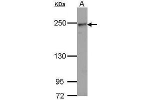 WB Image Sample (30 ug of whole cell lysate) A: Hela 5% SDS PAGE antibody diluted at 1:1000 (COL4a2 Antikörper)