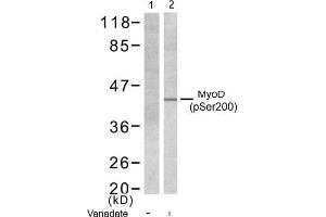 Image no. 1 for anti-Myogenic Differentiation 1 (MYOD1) (pSer200) antibody (ABIN196752) (MYOD1 Antikörper  (pSer200))