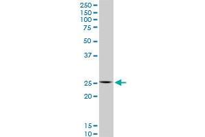 Western Blotting (WB) image for anti-Homeobox C12 (HOXC12) (AA 1-100) antibody (ABIN516656)