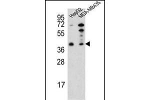 PARP16 Antikörper  (C-Term)