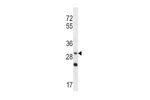 Western blot analysis in NCI-H292 cell line lysates (35ug/lane). (WNT3A Antikörper  (AA 151-180))