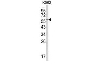 Western blot analysis of CYP8B1 Antibody (C-term) in K562 cell line lysates (35ug/lane). (CYP8B1 Antikörper  (C-Term))