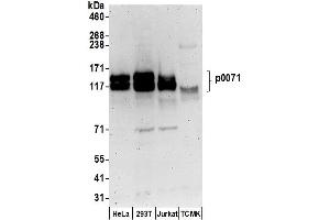 anti-Plakophilin 4 (PKP4) (AA 1-50) antibody