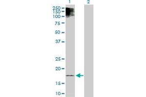 Western Blot analysis of ESM1 expression in transfected 293T cell line by ESM1 MaxPab polyclonal antibody. (ESM1 Antikörper  (AA 1-184))