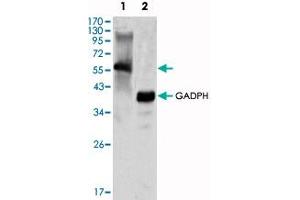 Western blot analysis using MATK monoclonal antibody, clone 9D7  against K-562 cell lysate. (MATK Antikörper)