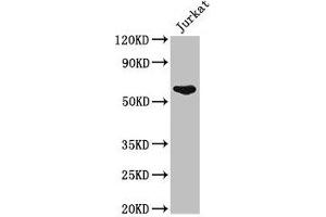Western Blot Positive WB detected in: Jurkat whole cell lysate All lanes: UAP1 antibody at 2. (UAP1 Antikörper  (AA 1-522))