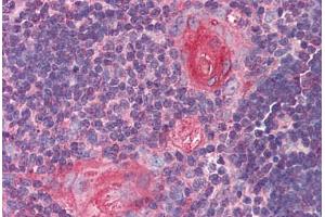 Human Thymus (formalin-fixed, paraffin-embedded) stained with SMC4 antibody ABIN290379 at 5 ug/ml followed by biotinylated goat anti-rabbit IgG secondary antibody ABIN481713, alkaline phosphatase-streptavidin and chromogen. (SMC4 Antikörper  (AA 281-297))