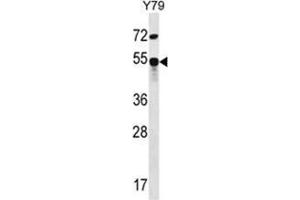 ZFP14 Antibody (N-term) western blot analysis in Y79 cell line lysates (35 µg/lane).