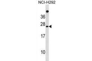 Western Blotting (WB) image for anti-Mannose-P-Dolichol Utilization Defect 1 (MPDU1) antibody (ABIN3001379) (MPDU1 Antikörper)