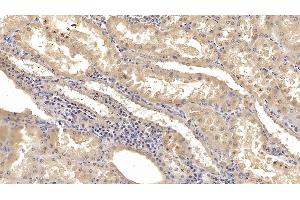 Detection of KPNa2 in Human Kidney Tissue using Monoclonal Antibody to Karyopherin Alpha 2 (KPNa2) (KPNA2 Antikörper  (AA 157-412))