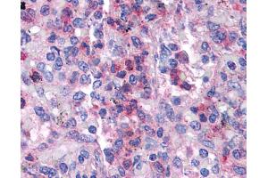 SGK3 antibody was used for immunohistochemistry at a concentration of 4-8 ug/ml. (SGK3 Antikörper  (N-Term))