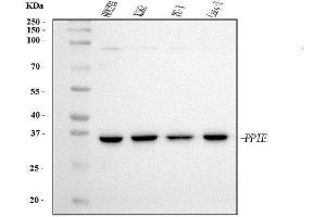 Western blot analysis of Cyclophilin E/PPIE using anti-Cyclophilin E/PPIE antibody (ABIN7599242). (PPIE Antikörper  (AA 1-301))