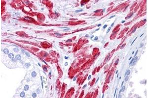 Human Prostate: Formalin-Fixed, Paraffin-Embedded (FFPE) (STAT5B Antikörper  (AA 180-229))