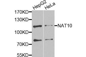 Western blot analysis of extracts of various cell lines, using NAT10 antibody. (NAT10 Antikörper)