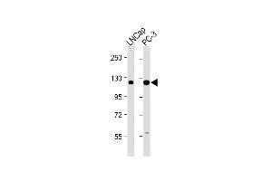 All lanes : Anti-DS Antibody (N-term) at 1:2000 dilution Lane 1: LNCap whole cell lysate Lane 2: PC-3 whole cell lysate Lysates/proteins at 20 μg per lane.