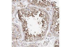 Immunohistochemical staining of human testis with C6orf118 polyclonal antibody  shows strong cytoplasmic positivity in subsets of seminiferus duct cells at 1:50-1:200 dilution. (C6ORF118 Antikörper)