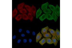 ABIN6256370 and ABIN6267611 staining Hela cells(30 min of UV treatment) by IF/ICC.