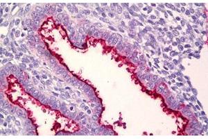 Anti-MUC16 / CA-125 antibody IHC staining of human uterus, endometrium. (MUC16 Antikörper  (AA 13311-13360))