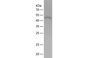 Western Blotting (WB) image for Ras Homolog Gene Family, Member B (RHOB) (AA 1-196) protein (His-IF2DI Tag) (ABIN7124785) (RHOB Protein (AA 1-196) (His-IF2DI Tag))
