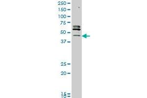 STK32C monoclonal antibody (M05), clone 3E8 Western Blot analysis of STK32C expression in MCF-7 . (STK32C Antikörper  (AA 1-369))
