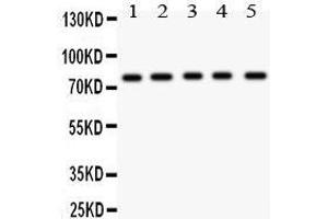 Anti- MCAK antibody, Western blotting All lanes: Anti MCAK  at 0. (KIF2C Antikörper  (AA 531-725))