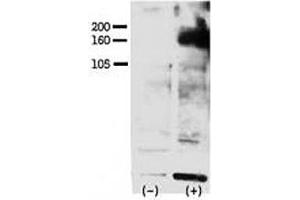Western blot testing of phospho-ERBB4 antibody and FG pancreatic carcinoma cells treated with or without EGF (50ng/ml) for 15 min. (ERBB4 Antikörper  (pTyr1162))