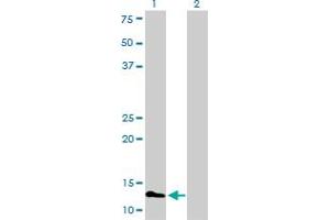 Western Blotting (WB) image for anti-Fatty Acid Binding Protein 3, Muscle and Heart (FABP3) (AA 1-133) antibody (ABIN560837)