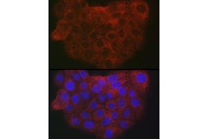 Immunofluorescence analysis of A-431 cells using Collagen I/COL1 antibody (ABIN6134502, ABIN6138839, ABIN6138840 and ABIN6221469) at dilution of 1:25. (COL1A2 Antikörper  (AA 500-600))