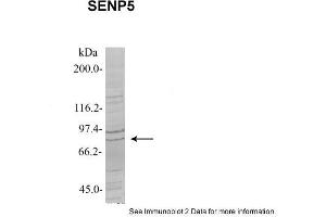 Sample Type: 1. (SENP5 Antikörper  (Middle Region))