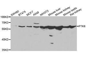 Western blot analysis of extracts of various cell lines, using PTK6 antibody. (PTK6 Antikörper  (AA 222-451))