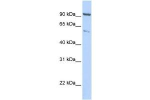 Western Blotting (WB) image for anti-Kinesin Heavy Chain Member 2A (KIF2A) antibody (ABIN2458064) (KIF2A Antikörper)