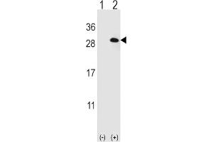 Western Blotting (WB) image for anti-Eukaryotic Translation Initiation Factor 4E Family Member 2 (EIF4E2) antibody (ABIN3001010) (EIF4E2 Antikörper)