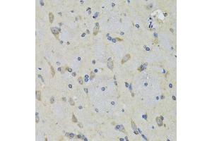 Immunohistochemistry of paraffin-embedded rat brain using RAE1 antibody (ABIN5974056) at dilution of 1/100 (40x lens). (RAE1 Antikörper)