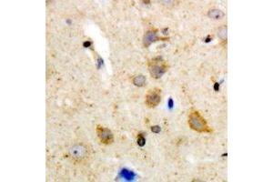 Immunohistochemical analysis of BLK staining in human brain formalin fixed paraffin embedded tissue section. (BLK Antikörper  (C-Term))