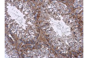 Immunohistochemistry (IHC) image for anti-Mechanistic Target of Rapamycin (serine/threonine Kinase) (mTOR) (C-Term) antibody (ABIN2855088)