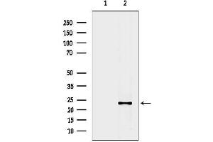 Western blot analysis of lysates from Mouse liver, using CYBA Antibody.