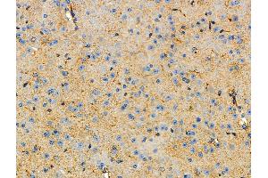 ABIN6264641 and ABIN6277740 at 1/100 staining Mouse brain tissue by IHC-P. (RAPTOR Antikörper  (C-Term))