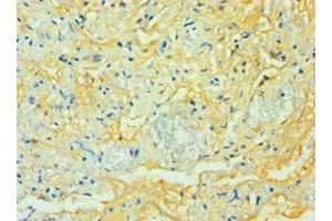 Immunohistochemistry of paraffin-embedded human lung tissue using ABIN7171585 at dilution of 1:100 (TTBK2 Antikörper  (AA 1185-1244))