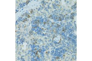 Immunohistochemistry of paraffin-embedded rat spleen using TJP2 antibody. (TJP2 Antikörper)