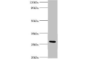 Western blot All lanes: C4b-binding protein beta chain antibody at 6 μg/mL + Mouse liver tissue Secondary Goat polyclonal to rabbit IgG at 1/10000 dilution Predicted band size: 28 kDa Observed band size: 28 kDa (C4BPB Antikörper  (AA 18-252))