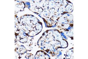 Immunohistochemistry of paraffin-embedded Human placenta using p38 MAPK Rabbit pAb (ABIN7268615) at dilution of 1:100 (40x lens). (MAPK14 Antikörper  (AA 1-360))
