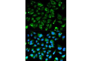 Immunofluorescence analysis of HeLa cell using PRKAR1A antibody. (PRKAR1A Antikörper)