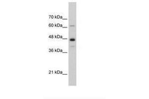 Image no. 1 for anti-Nuclear RNA Export Factor 1 (NXF1) (AA 78-127) antibody (ABIN6736311) (NXF1 Antikörper  (AA 78-127))