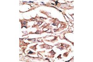 Image no. 2 for anti-Dickkopf 2 Homolog (DKK2) (C-Term) antibody (ABIN357070) (DKK2 Antikörper  (C-Term))