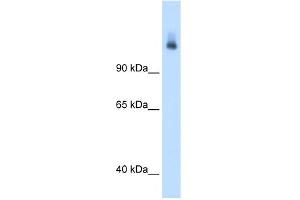 WB Suggested Anti-CPS1 Antibody Titration:  1. (CPS1 Antikörper  (N-Term))